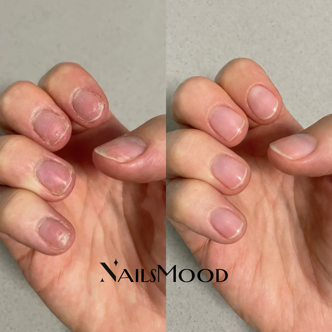 SÉRUM RÉPARATEUR POUR ONGLES